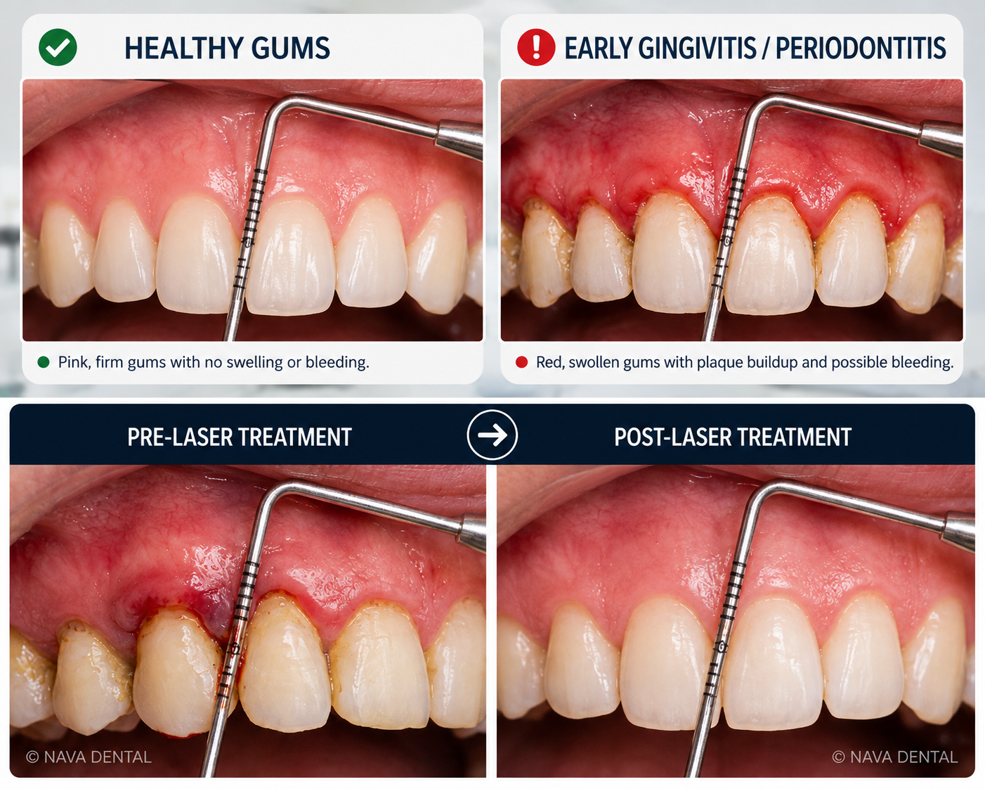 10 Signs Your Gums Are Trying to Tell You Something